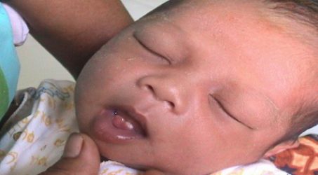 Fenomena Langka Natal Teeth, Bayi Lahir Sudah Bergigi
