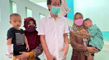 Sido Muncul Gelar Operasi Sumbing Bibir Gratis di Tangerang